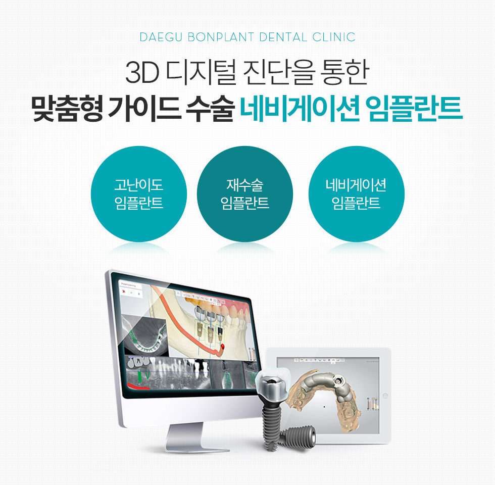 3D 디지털 진단을 통한 맞춤형 가이드 수술  네비게이션 임플란트